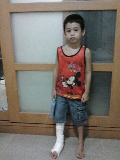 Brian, much younger than eleven, standing against a door in a below-knee cast on the right leg. Tony's account puts this at the first operation, when the tumour was found and removed.